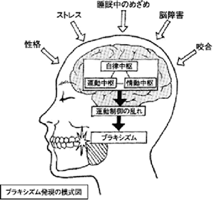 歯ぎしりの原因は?