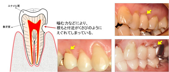 歯科 wsd とは